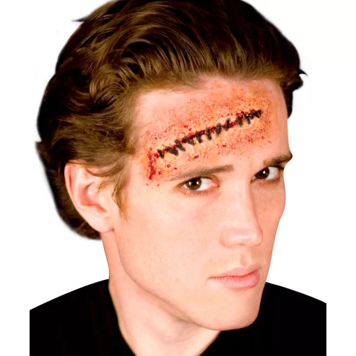 Stitches Appliance